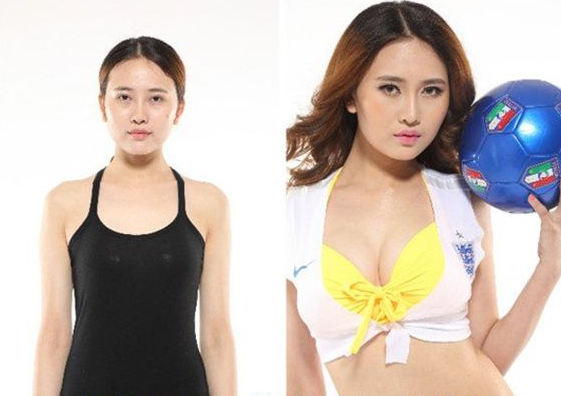 硅胶丰胸会有什么危害 硅胶丰胸会有什么危害