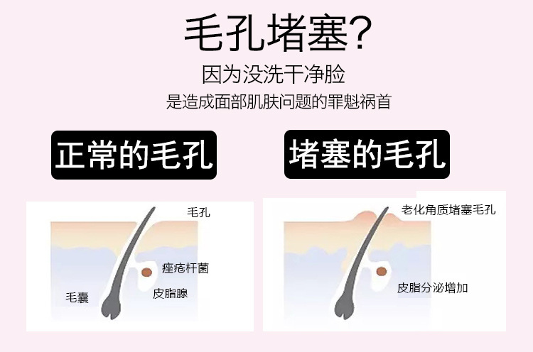 硅胶洗脸刷,硅胶章鱼洗脸刷,硅胶洁面刷,硅胶洗脸神器 硅胶洗脸刷,硅胶章鱼洗脸刷,硅胶洁面刷,硅胶洗脸神器